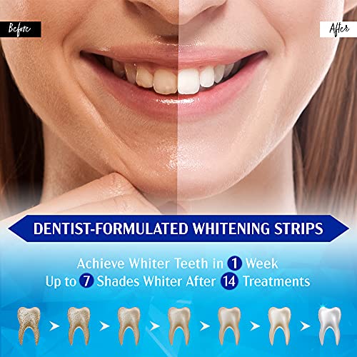 Beautzilla Teeth Whitening Strips - Safe Formula for Sensitive Teeth Teeth Wh...