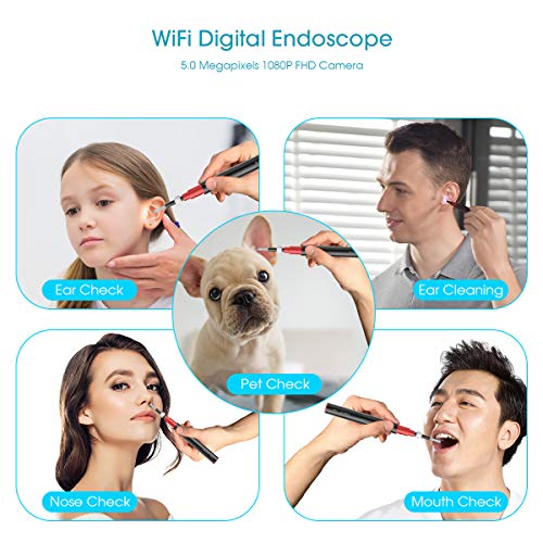 BEBIRD® A2 SE Ear Cleaner Ultra Thin 3.5mm 1080p HD Wireless Pocket 5 LED Ear...