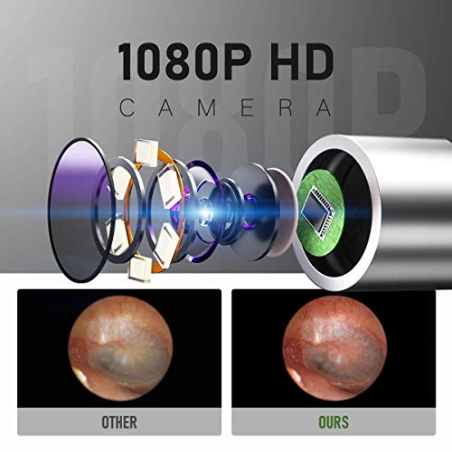 BEBIRD® C3 Ear Cleaner, Ear Wax Removal Tool Wireless Otoscope with 1080P HD ...
