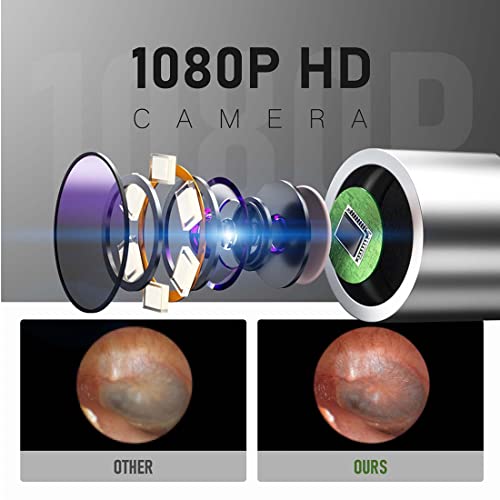 BEBIRD® C3 Ear Wax Removal, Ear Cleaner with Camera Wireless Otoscope with 10...