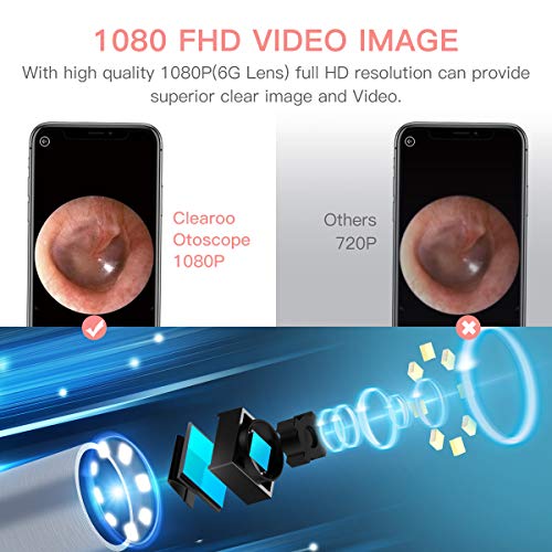 BEBIRD Ear Wax Removal Endoscope, Earwax Remover Tool, Ear Camera,1080P FHD W...