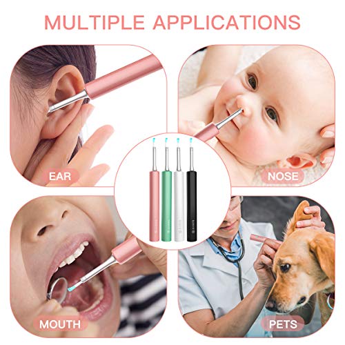 BEBIRD Ear Wax Removal Endoscope, Earwax Remover Tool, Ear Camera,1080P FHD W...
