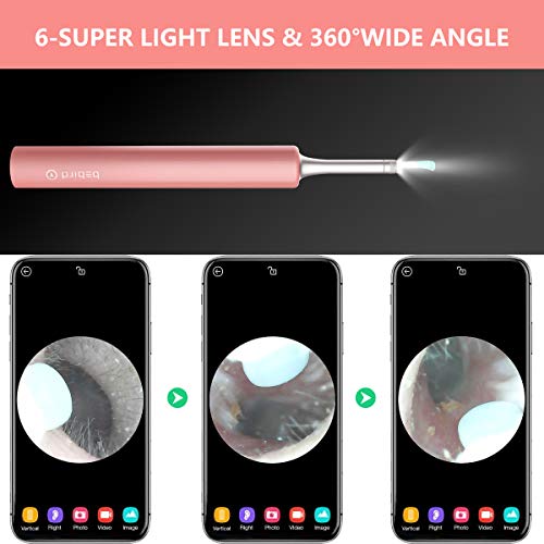 BEBIRD Ear Wax Removal Endoscope, Earwax Remover Tool, Ear Camera,1080P FHD W...