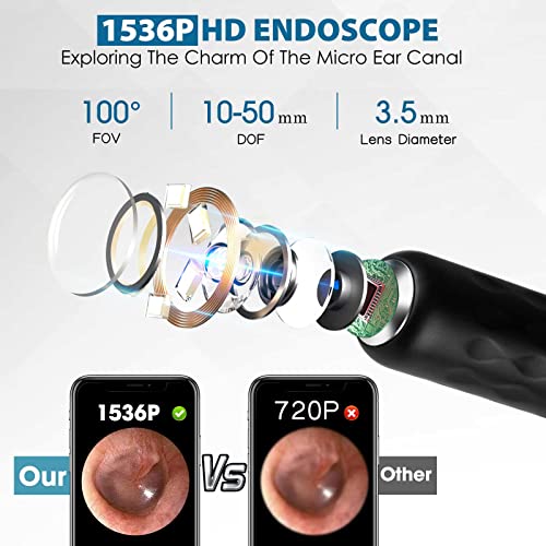 BEBIRD Ear Wax Removal Tool Kit 1960P HD Ear Camera, WiFi Smart Ear Cleaner w...