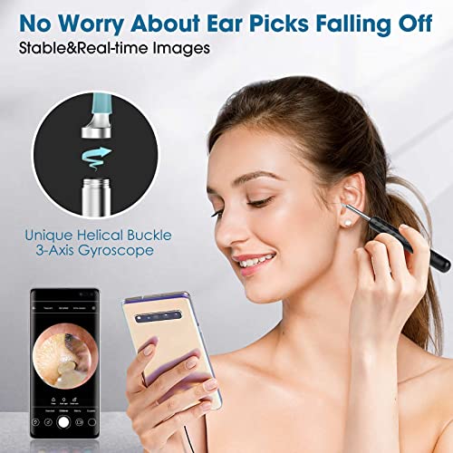 BEBIRD Ear Wax Removal Tool Kit 1960P HD Ear Camera, WiFi Smart Ear Cleaner w...