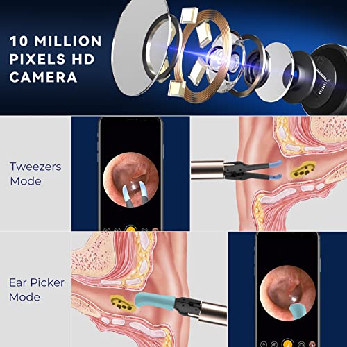 Bebird Note3 Pro Earwax Remover Endoscope Cleaner Pick Kit with Camera, Wirel...