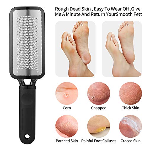 Foot Scrubber, Stocking Stuffers Callus Remover For Feet,Professional Foot Fi...