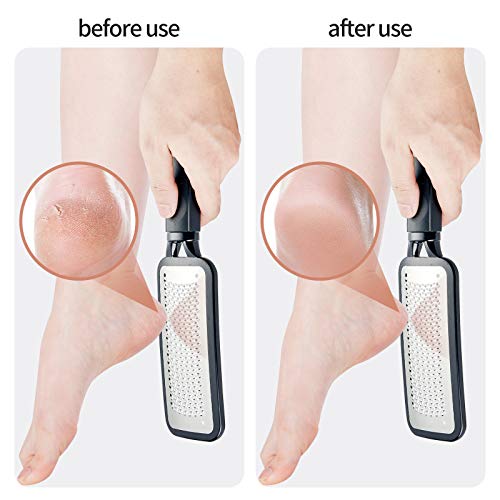 Foot Scrubber, Stocking Stuffers Callus Remover For Feet,Professional Foot Fi...