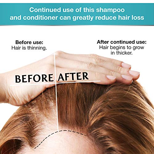 Biotin Shampoo and Conditioner Set for Hair Growth | Thickening Hair Loss Sha...
