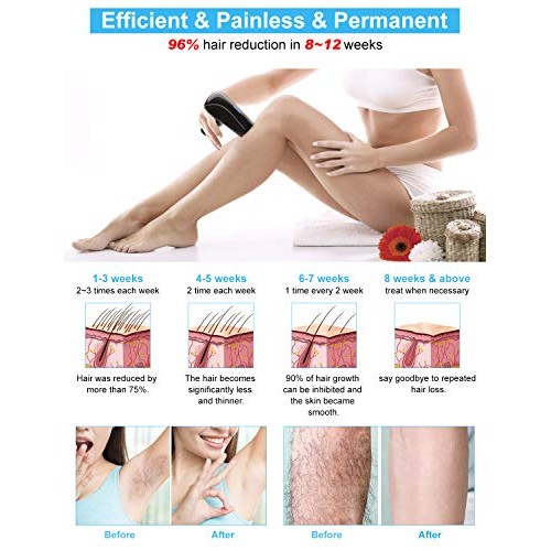 Professional Laser Hair Removal for Women Men, BeMyLady 999,000 Flashes IPL P...
