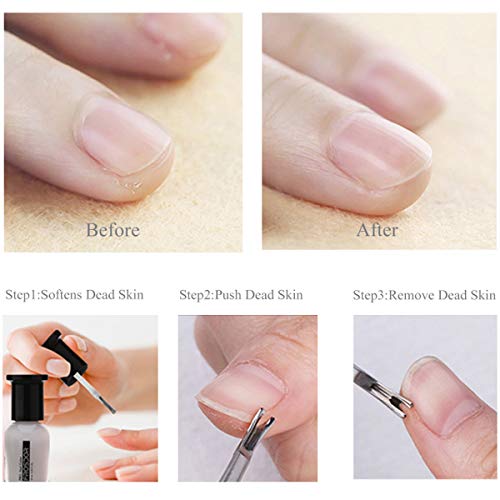 6PCS Cuticle Pusher Set, Stainless Steel Cuticle Remover Kit, Cutter and Trim...