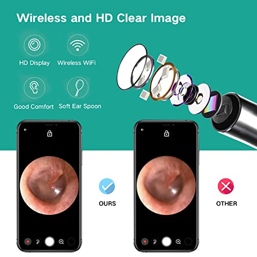Ear Wax Removal, Ear Cleaner with Camera, Earwax Remover Tool, 1080p HD Water...