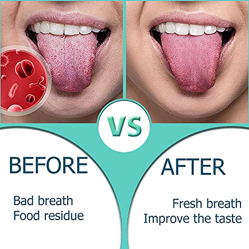 Tongue Scraper,Medical Grade Tounge Scraper Cleaner,Stainless Steel 100% BPA ...