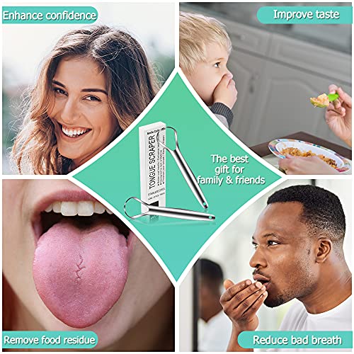 Tongue Scraper,Medical Grade Tounge Scraper Cleaner,Stainless Steel 100% BPA ...