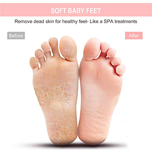 BESKAR Larger Shower Foot Scrubber Mat with Non-Slip Suction Cups- Cleans, Sm...