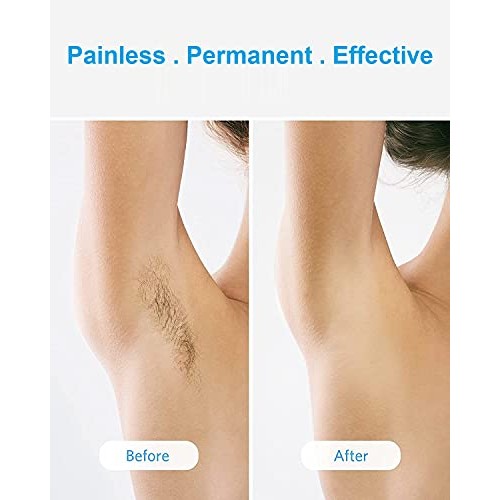 BESTEK IPL Hair Removal Permanent Painless Laser Hair Remover Device for Wome...