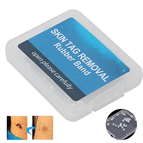 30Pcs Skin Tag Removal Rubber Bands, Skin Tag Remover Device, Safe Micro Band...