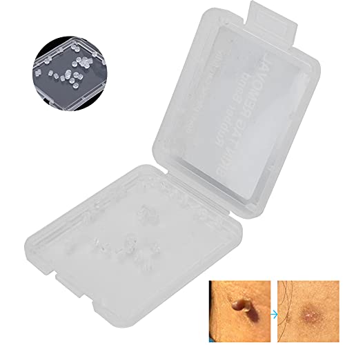 30Pcs Skin Tag Removal Rubber Bands, Skin Tag Remover Device, Safe Micro Band...