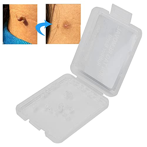 30Pcs Skin Tag Removal Rubber Bands, Skin Tag Remover Device, Safe Micro Band...