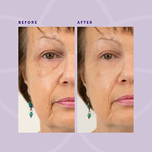 Beverly Hills Instant Facelift and Eye Serum Treatment for Dark Circles, Puff...