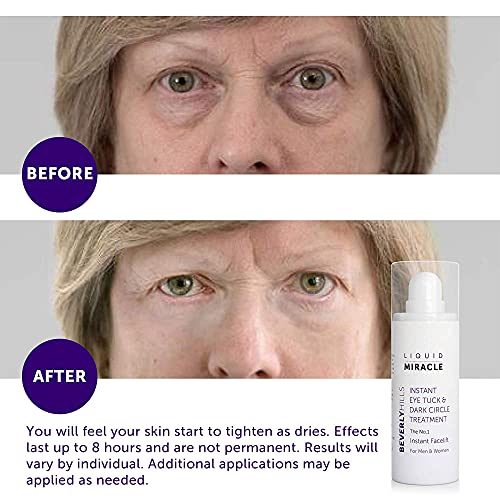 Beverly Hills Instant Facelift and Eye Serum Treatment for Dark Circles, Puff...