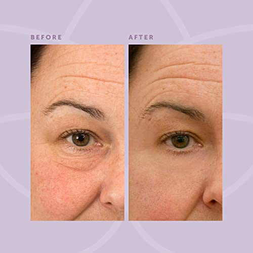 Beverly Hills V-Lift Instant Eye Lift and Eye Tuck Bee Venom Serum for Treati...