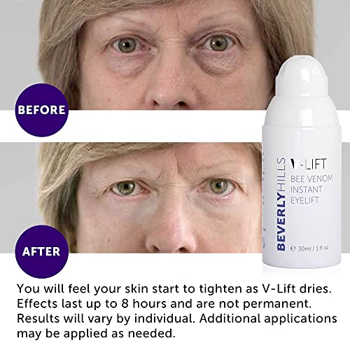 Beverly Hills V-Lift Instant Eye Lift and Eye Tuck Bee Venom Serum for Treati...