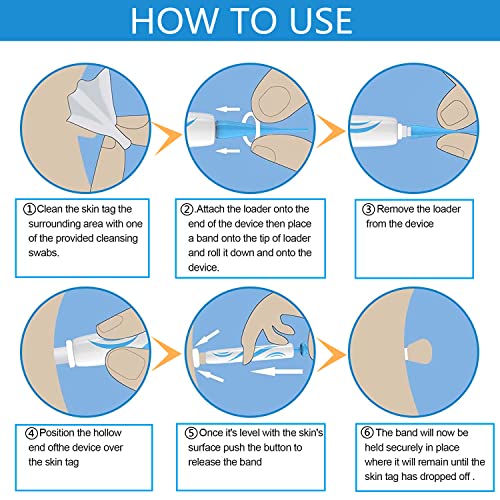 2 in 1 Skin Tag Remover for Small/Medium Skin Tags, Wart Removal Painless and...