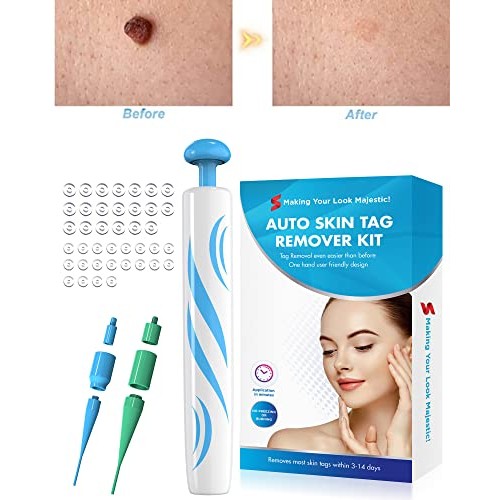 2 in 1 Skin Tag Remover for Small/Medium Skin Tags, Wart Removal Painless and...