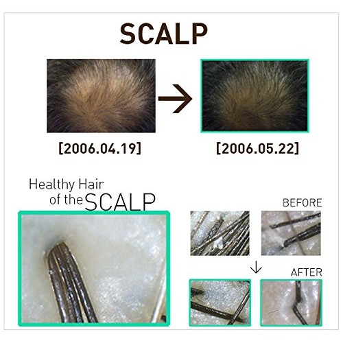 Dr Ross' BIOGEM pH-Balanced Revitalizing Shampoo For Oily Hair - 355ml