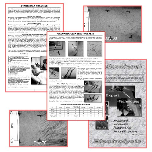 Permanent Hair Removal Transdermal Electrolysis Machine.