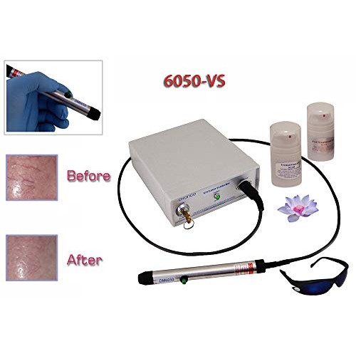 Unwanted vein and capillary removal device with economy accessory kit.
