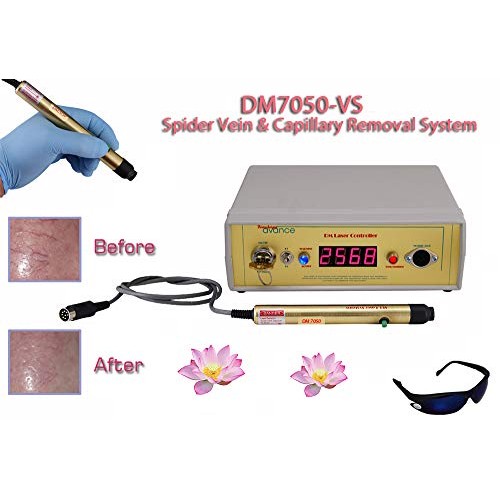 Vein & Broken Capillary Reduction Equipment with Deluxe Gel Accessory Treatme...
