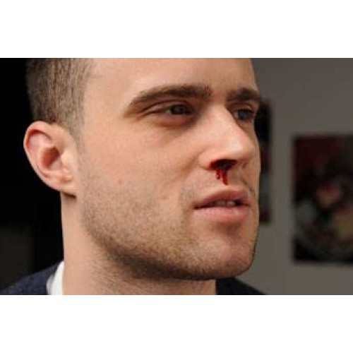 BLEEDCEASE Stop Bleeding STERILE 25 Count 2 Pack