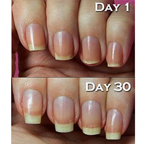 Bliss Kiss Simply Pure Cuticle & Nail Oil Pen To-Go 2ml - Crisp Scent 1PEN-CRI