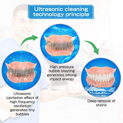 Ultrasonic Denture Cleaner, BlumWay Profession Retainer/Aligner/Mouth Guard C...