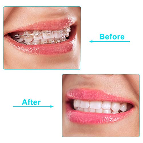 20 Pieces Aligner Tray Seaters Chewies for Aligner Trays Chompers Aligner Tra...