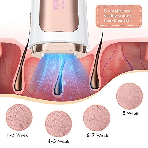 Hair Removal for Women and Men Hair Remover Device with Sunglasses and Shavin...