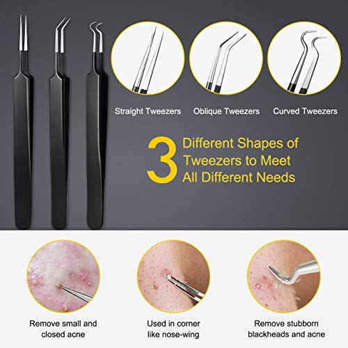 Pimple Popper Tool Kit - Boxoyx 10 Pcs Blackhead Remover Comedone Extractor K...