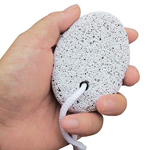 The Original Pumice Stone for Feet and Foot File Set – Rust-Resistant Stainle...