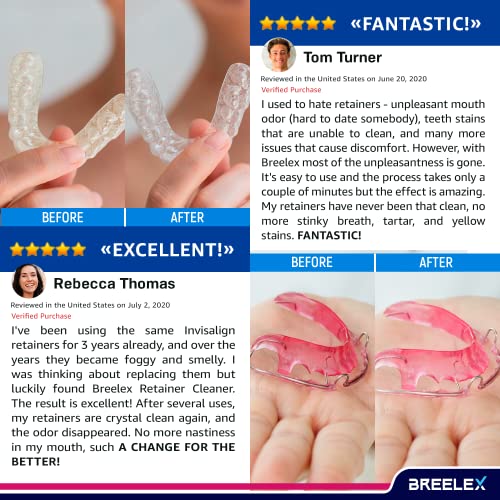 Denture Cleaning Tablets - Retainer Cleaner for Aligner, Mouth & Night Guard ...