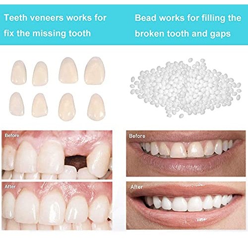 Brige Temporary Tooth Repair kit for Filling The Missing Broken Tooth and Gap...