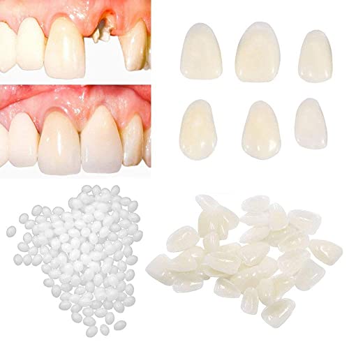 Brige Temporary Tooth Repair kit for Filling The Missing Broken Tooth and Gap...