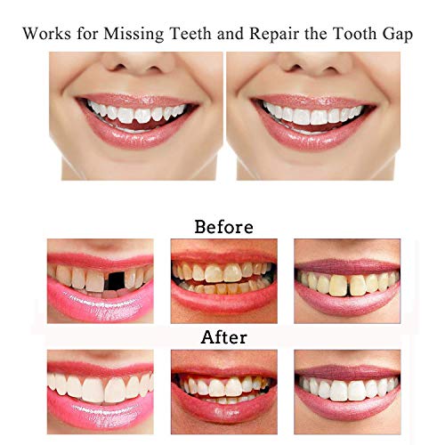 Temporary Tooth Repair Kit-Thermal Beads for Filling Fix the Missing and Brok...