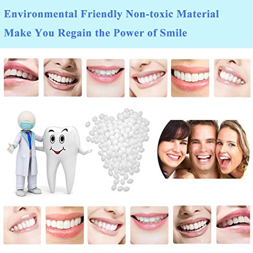 Temporary Tooth Repair Kit-Thermal Beads for Filling Fix the Missing and Brok...