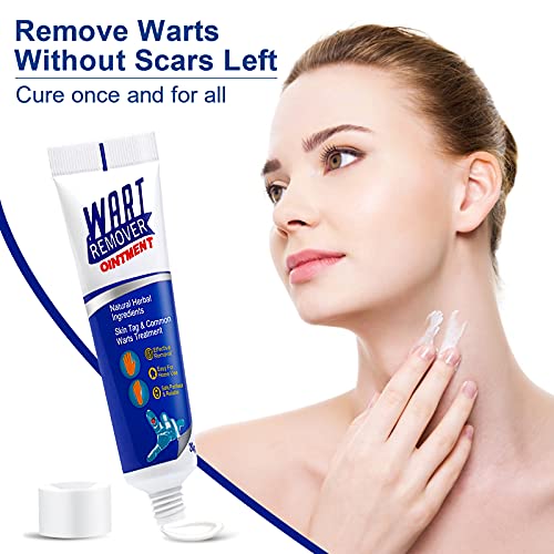 2 Pack Foot Skin Removal Cream,Foot Care Removal Cream,Mole Cream