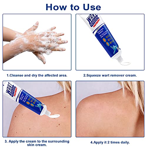 2 Pack Foot Skin Removal Cream,Foot Care Removal Cream,Mole Cream