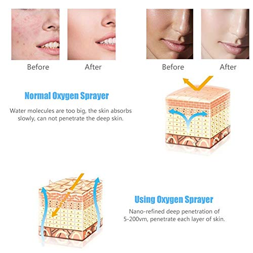 Hydrogen Oxygen Facial Beauty Machine, Moisturizing Hydrate Jet Injection Spr...