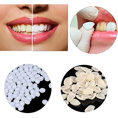 Temporary Tooth Repair Kit, Temporary Tooth Repair Kit Dental Cavity, Gaps Fi...