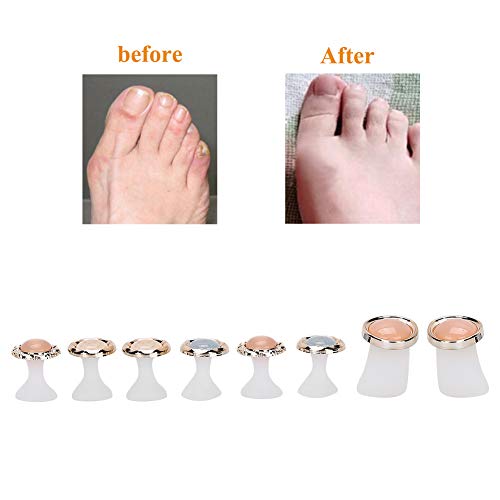 Toe Separator, 8 Pcs Washable Reusable Toe Separation Tool Pedicure Care, Sil...